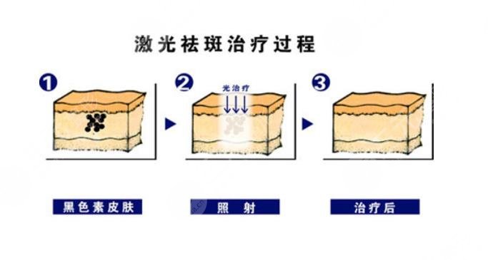 龍華人民醫(yī)院祛斑皮膚科科室介紹