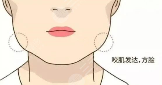 咬肌怎么變小快速的方法不動刀！照搬文中的方法可以讓你更快的變小臉~