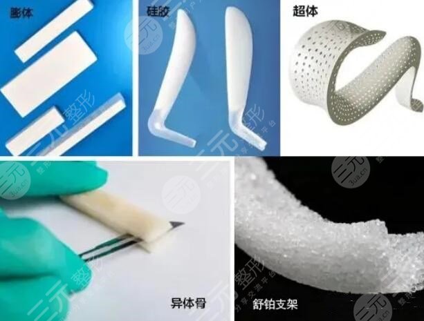 做個鼻梁需要多少錢費用？