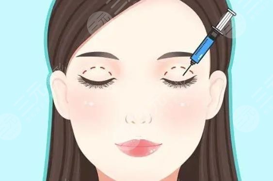 激光雙眼皮
