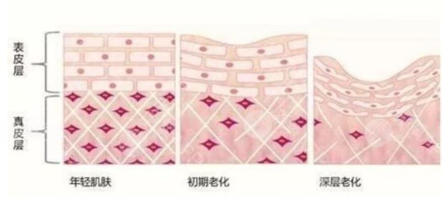 除皺