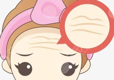 抬頭紋