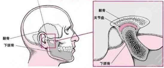 假體隆下巴的注意事項
