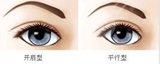 內(nèi)雙割雙眼皮多?少錢
