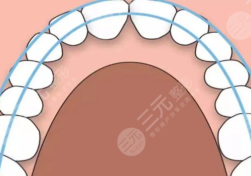 牙齒矯正一般要多少錢？