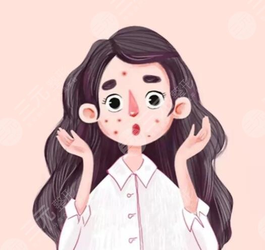 復(fù)合彩光去痘幾次有？復(fù)合彩光去痘的原理和果解析，網(wǎng)友打卡后反饋~