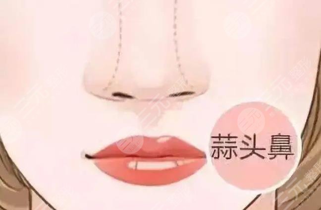 鼻頭整形