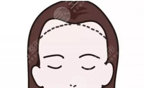 發(fā)際線(xiàn)