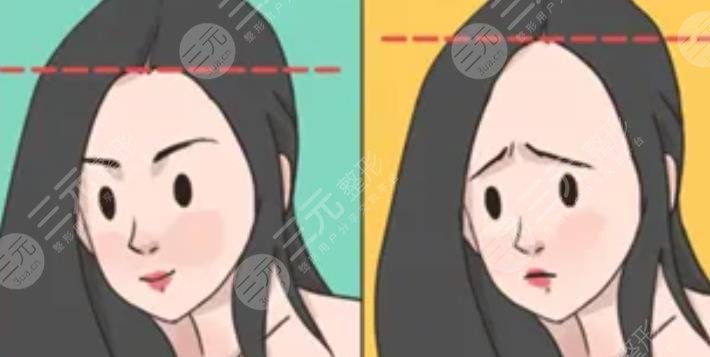 發(fā)際線(xiàn)
