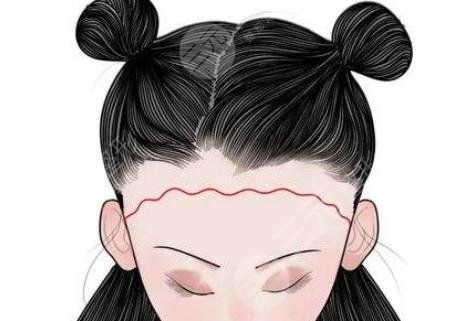 發(fā)際線(xiàn)