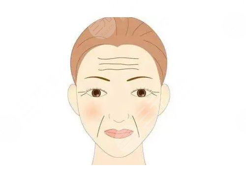 怎樣去除抬頭紋和魚尾紋?