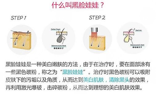 黑臉娃娃