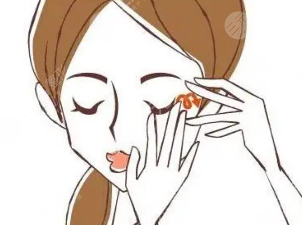 魚尾紋