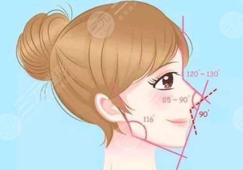 塌鼻子隆鼻后會好看嗎?