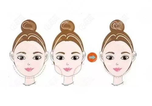 深圳悅她醫(yī)療美容張赫醫(yī)生怎么樣?