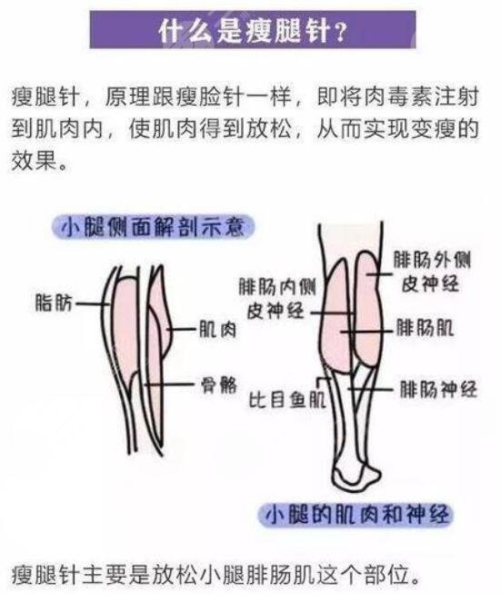 肌肉小腿怎么瘦成筷子腿肚子？
