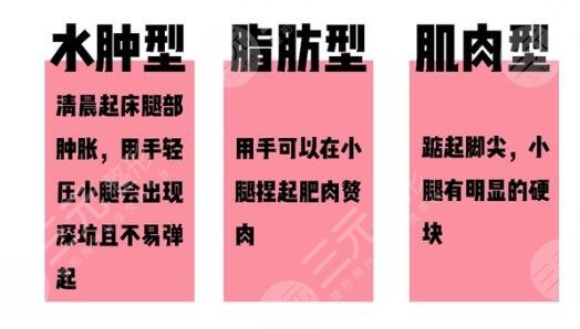 抽脂改良肌肉小腿有哪些注意事項？