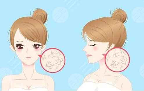 什么可以去紅血絲的方法簡單又有?