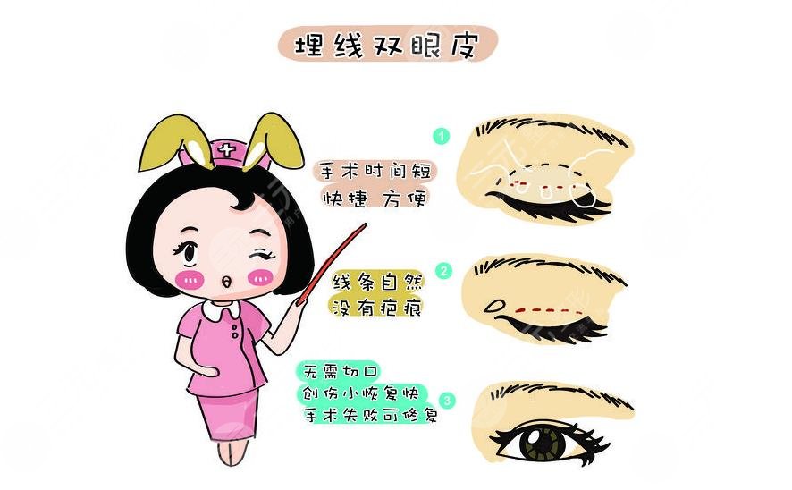 怎樣可以卸掉雙眼皮貼呢?