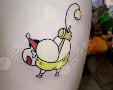 去掉紋身