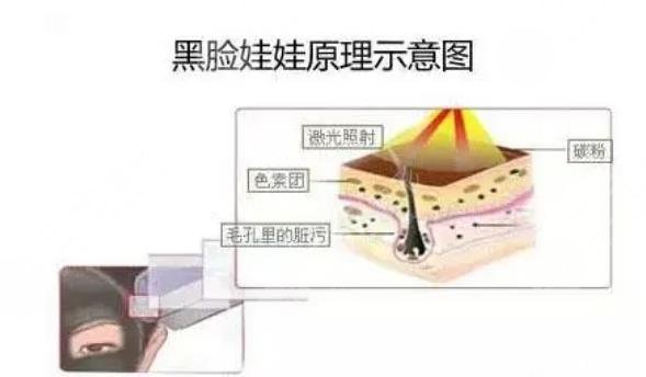 黑臉娃娃