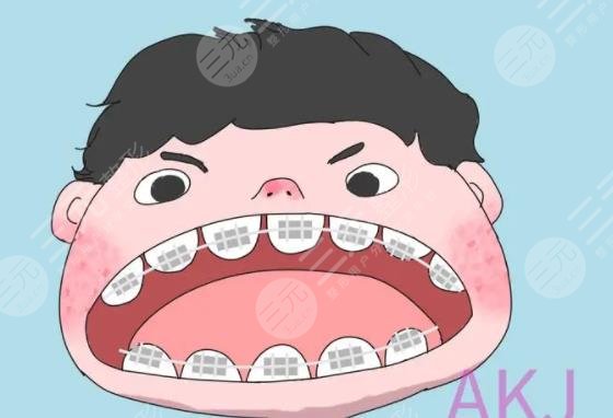 牙齒矯正