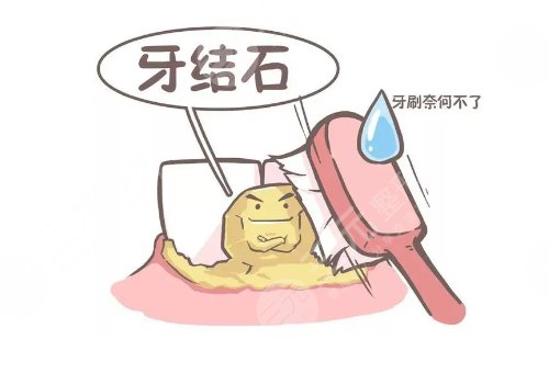 超聲波潔牙可靠嗎？