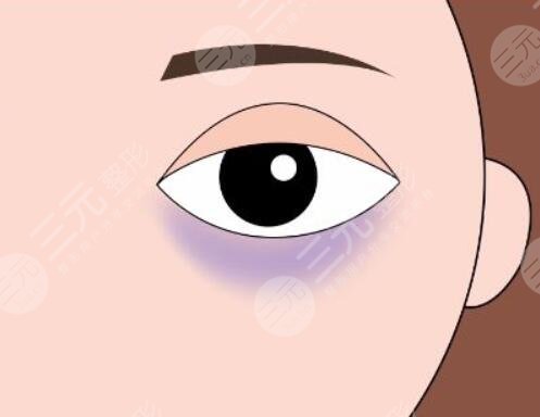 　　吃什么緩解黑眼圈果好又快速?黑眼圈可以說是我們的災(zāi)難，稍微不注意黑眼圈就悄悄的冒了出來，即便擁有一張白皙靚麗的臉龐也忍受不了黑眼圈的出現(xiàn)，黑黑的黑眼圈一旦出現(xiàn)在臉上，就會讓我們看起來沒有精神，整個人焉了吧唧的。為了解決免不黑眼圈的問題，大家各種各樣的方法都是使用，目前使用的比較多的是使用各種各樣的眼霜，或者是通過醫(yī)美整形的方式來改良，又或者是通過飲食的改變來改良黑眼圈的問題，那么吃什么緩解黑眼圈?現(xiàn)在就和小編一起來認(rèn)真的做一下功課吧!  　　一、黑眼圈是怎么出現(xiàn)的?  　　黑眼圈出現(xiàn)的原因有很多種，比較常見的一種是長時間的熬夜，導(dǎo)致眼部疲勞血液流通不暢，出現(xiàn)了紫紅色或者是青色的黑眼圈。還有一種是色素性黑眼圈，出現(xiàn)這種情況的原因有很多中，不單單是因為熬夜導(dǎo)致的，還有一些外界因素的印象，主要指因為長時間在陽光下暴曬，過多的藥物攝入，做了一些眼部手術(shù)等等，以及買了一些不適合自己的化妝品，引發(fā)了眼周蕁麻疹反映，都會導(dǎo)致眼周出現(xiàn)色素沉淀，對于這種色素性黑眼圈，主要是叫撒后這些黑色的細(xì)胞，減少黑色色素。  　　二、吃什么緩解黑眼圈果好又快速?  　　既然有黑眼圈的出現(xiàn)，就要積極的找到一個有的緩解方式，目前就有很多人說可以通過食物來改良黑眼圈的問題。那么具體吃哪些東西比較有果了?  　　1、攝入高蛋白的食物，高蛋白的食物有很多種，主要是牛奶，雞蛋以及各種肉類，積極增加自己的蛋白質(zhì)攝入，可以有的緩解黑眼圈的形成，但是對高蛋白食物過敏的小伙伴，不建議使用這一種方法，大家可以通過其他的方式來改良自己黑眼圈的問題。  　　2、可以嘗試多吃一些動物的肝臟等食物，這些食物內(nèi)部含有為豐富的維生素a，這個維生素可以很好的為我們眼周和眼球提供必需的物質(zhì)，促進(jìn)眼周的血液循環(huán)，幫助緩解黑眼圈。同時吃各種各樣有營養(yǎng)的食物來改良黑圈，也是一個比較好的選擇，大家可以根據(jù)自身的條件來制定一個比較不錯的食譜。  　　三、醫(yī)美整形手術(shù)改良黑眼圈  　　除了通過吃東西來改良黑眼圈以外，還有一種可實施比較有的方法，那就是通過醫(yī)美整形的方式來改良黑眼圈。目前針對黑眼圈的醫(yī)美整形項目也有幾個，小編整理了一些作用果不錯的幾個項目，現(xiàn)在就分享給大家吧!  　　1、激光緩解黑眼圈  　　激光緩解黑眼圈是一個比較常見的醫(yī)美整形項目，也是當(dāng)下行之有的一種技術(shù)手段，他的操作難度不高，主要是通過激光的遠(yuǎn)紅外長脈沖激光，作用在眼周的皮膚上，慢慢的滲透到皮膚深層，讓激光產(chǎn)生的爆破光熱能量將這些黑色素打散，改良皮膚的生成代謝，促進(jìn)膠原代表的生成，在有去除黑眼圈的同時，也能樣眼周的皮膚更將光澤有彈性。這種激光緩解黑眼圈的方式一般適用于是色素性黑眼圈。  　　2、注射緩解黑眼圈  　　如果是結(jié)構(gòu)性的黑眼圈，一般采用玻尿酸或者是脂肪來進(jìn)行局部的注射填充來改良，這種黑眼圈一般是出現(xiàn)在家族遺傳病史上，隨著年紀(jì)的增加，到了十五六歲的時候就會出現(xiàn)結(jié)構(gòu)性的黑眼圈，這時候就可以采取局部注射緩解大，可以很好的減少這種情況的出現(xiàn)，既而改良黑眼圈的情況。想要通過醫(yī)美整形手段改良自己的黑眼圈情況的小伙伴，一定要去正規(guī)的整形機(jī)構(gòu)做手術(shù)，并且了解到自己出現(xiàn)黑眼圈的原因，才能制定一個可行的手術(shù)方案。