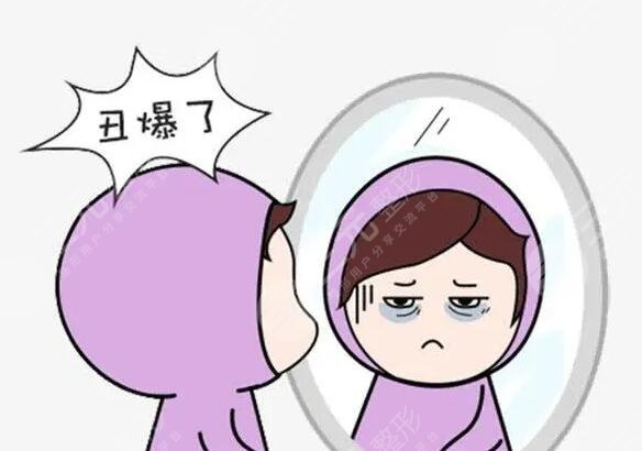 醫(yī)美整形手術(shù)改良黑眼圈