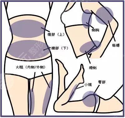 等離子激光溶脂有危害嗎？