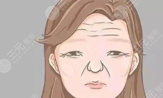 抬頭紋