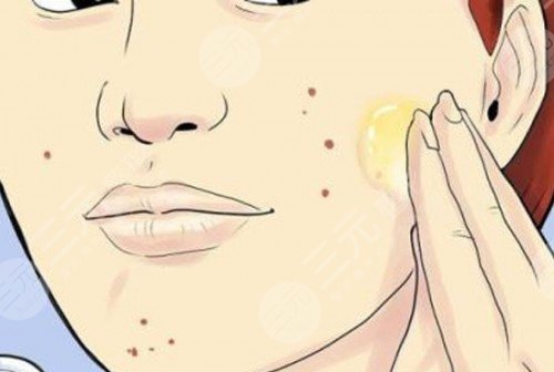 臉上有紅痘?印怎么消除?