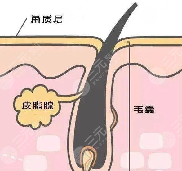 黑頭導(dǎo)出液哪個好用?