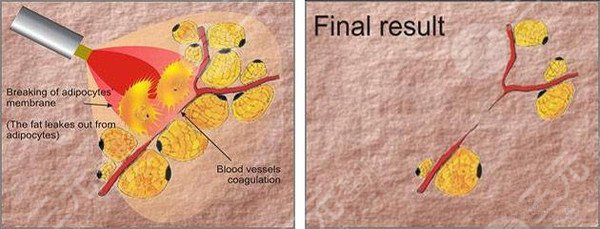 減肥需要注意什么?