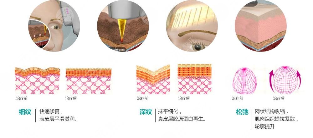 復(fù)合彩光緩解多少錢？