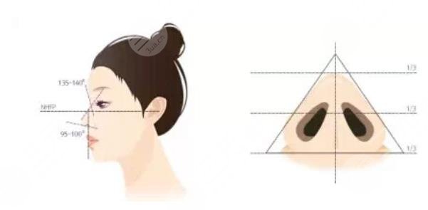 鼻翼縮小