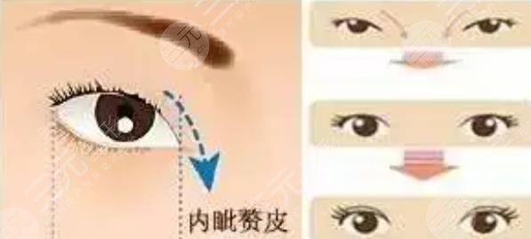 開眼角
