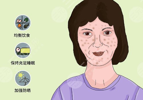 簡(jiǎn)單美白祛斑的方法有哪些？