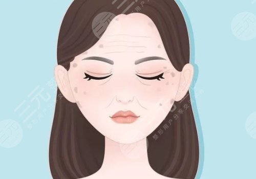 怎樣治老年斑？
