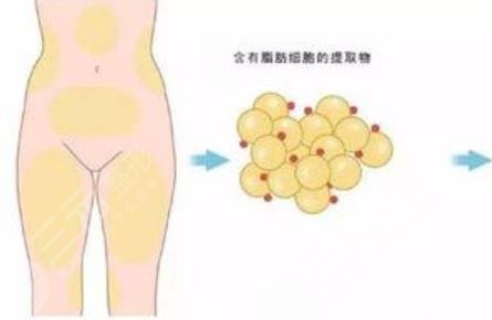 嫩膚