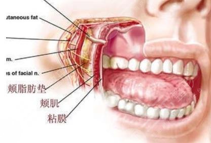 去頰脂墊手術(shù)介紹