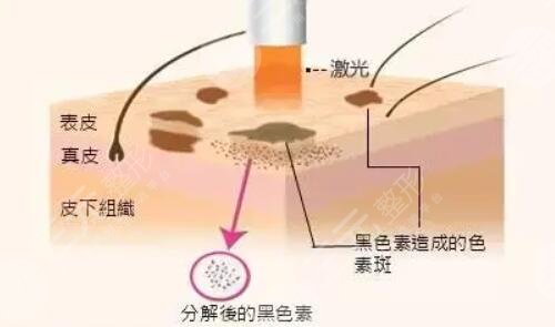 現(xiàn)在的醫(yī)美技術(shù)也發(fā)展的很不錯