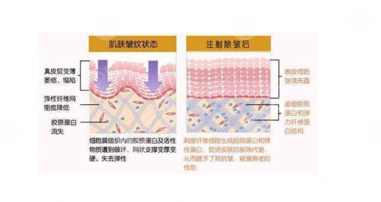 哪種膠原蛋白好?