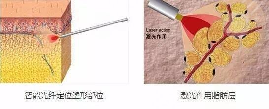 怎樣變瓜子臉？