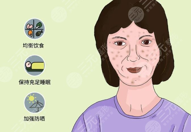 激光祛斑的優(yōu)勢(shì)