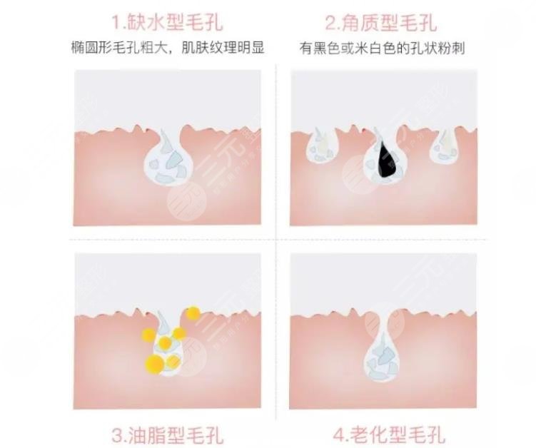 臉上的毛孔