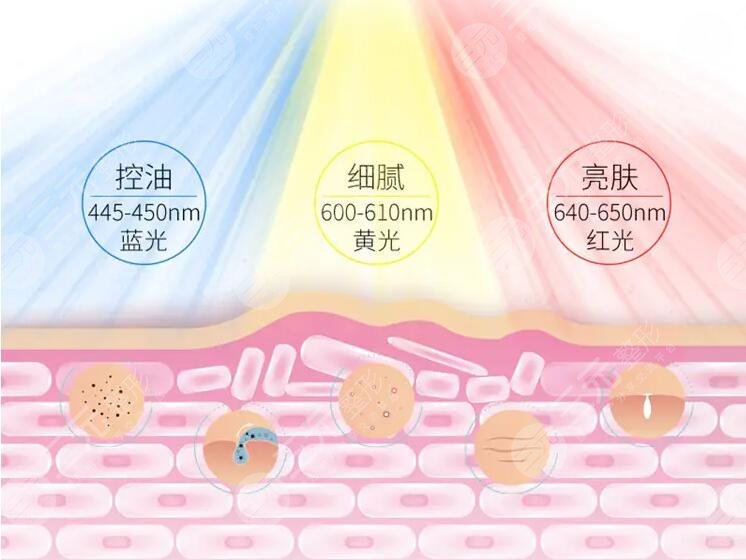 光子嫩膚