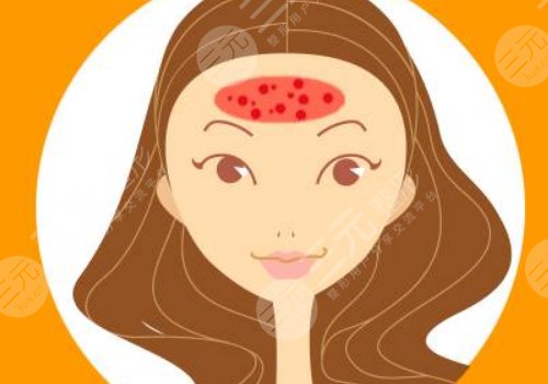 額頭長了很多密密麻麻的小痘痘是什么原因？