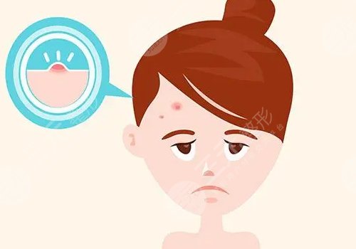 額頭長了很多密密麻麻的小痘痘是什么原因？