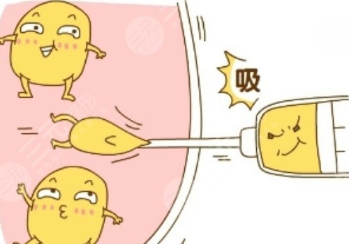 腹部抽脂術(shù)后需要修復幾天才能恢復？